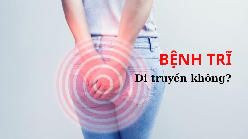 Bệnh trĩ có di truyền không?