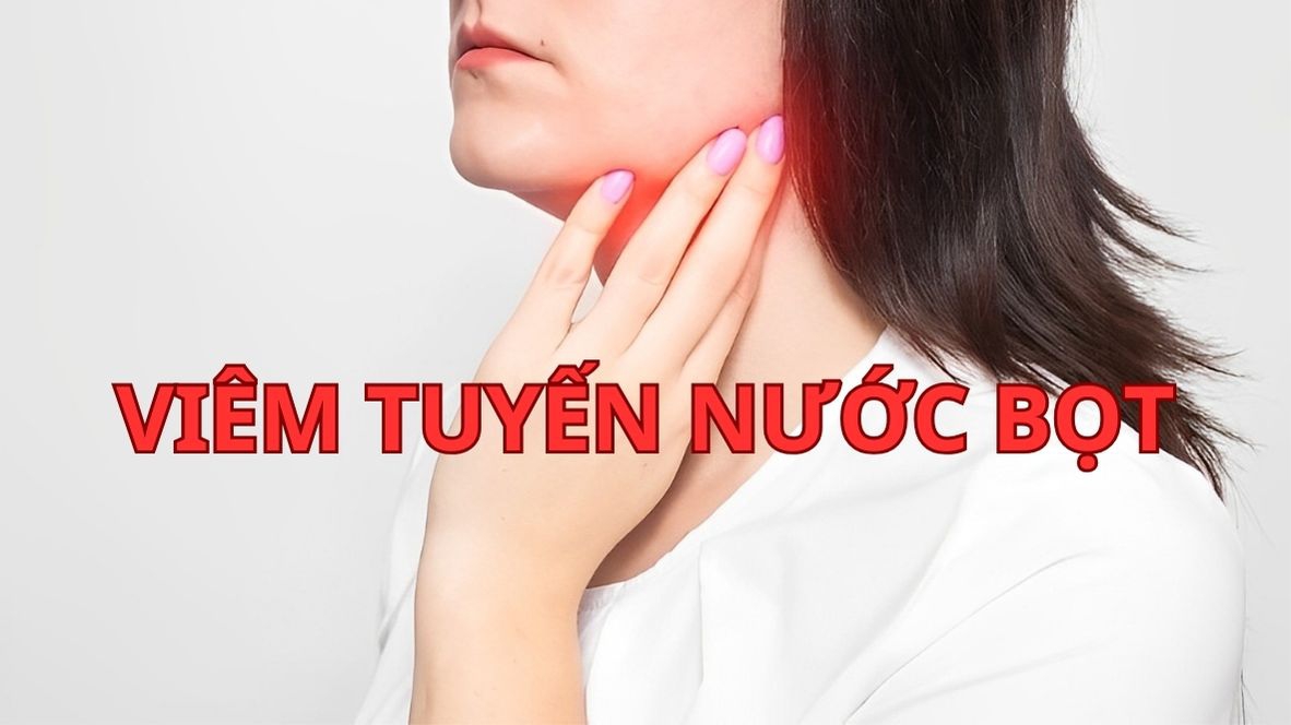 Bị viêm tuyến nước bọt bao lâu thì khỏi?