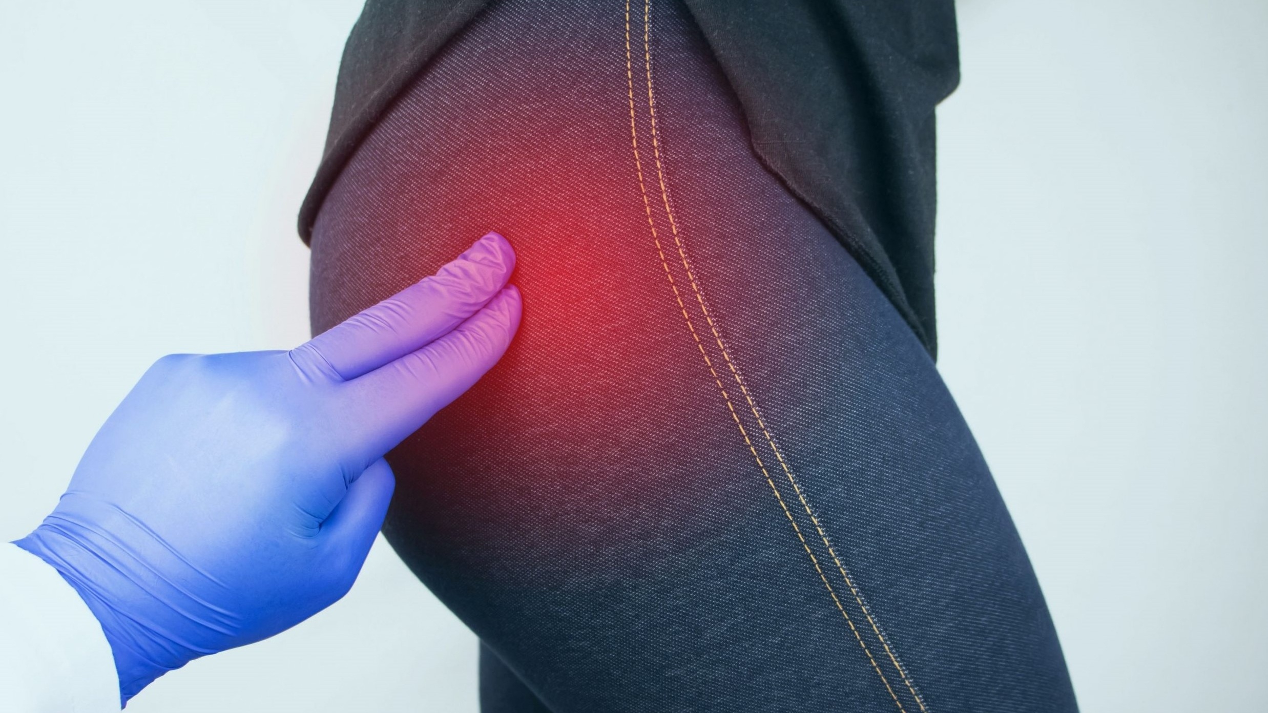 Có những tư thế nào giúp giảm đau cơ mông?

