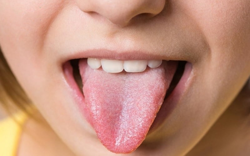 Các bệnh về lưỡi thường gặp: Nguyên nhân, triệu chứng và hướng điều trị 1