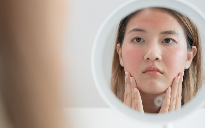 Các loại da cơ bản: Đặc điểm, cách chăm sóc và lời khuyên hữu ích 4