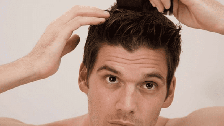 Nguyên nhân tóc nam giới bị khô xơ và cách trị tóc khô gãy hiệu quả