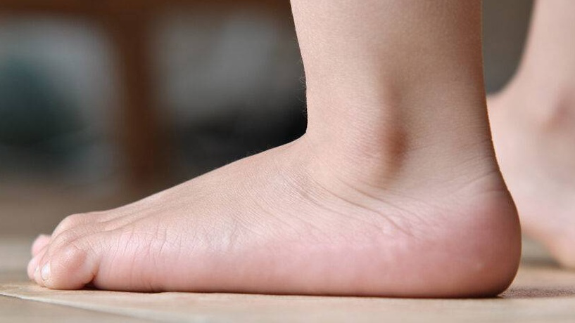 Quels sont les effets à long terme du pied bot non traité chez les adultes?