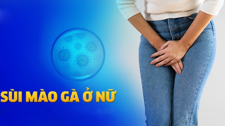 Cách chữa sùi mào gà ở nữ có những phương pháp nào?