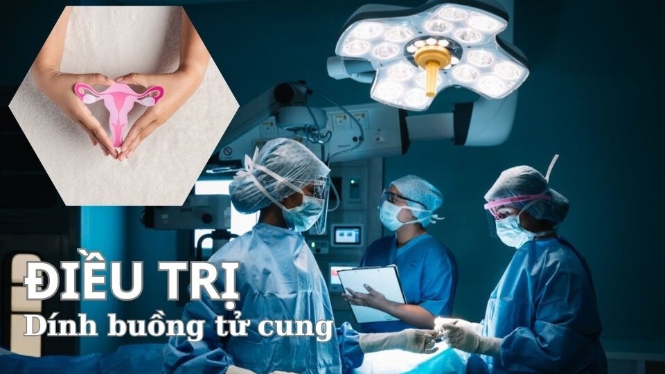 Cách điều trị dính buồng tử cung hiệu quả nhất hiện nay