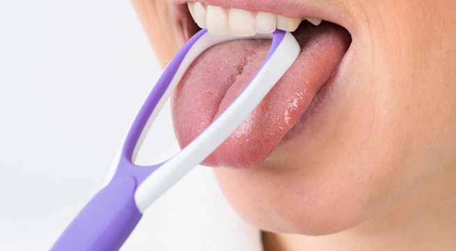 Những tế bào tích tụ và đóng vảy trên lưỡi gây mùi hôi khó chịu có thể liên quan đến lưỡi trắng hay không?