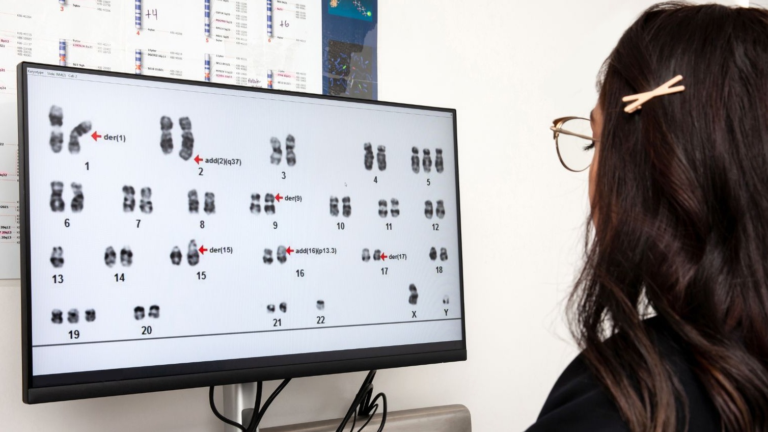 Xét nghiệm Karyotype là gì? Tìm hiểu về cách đọc Karyotype