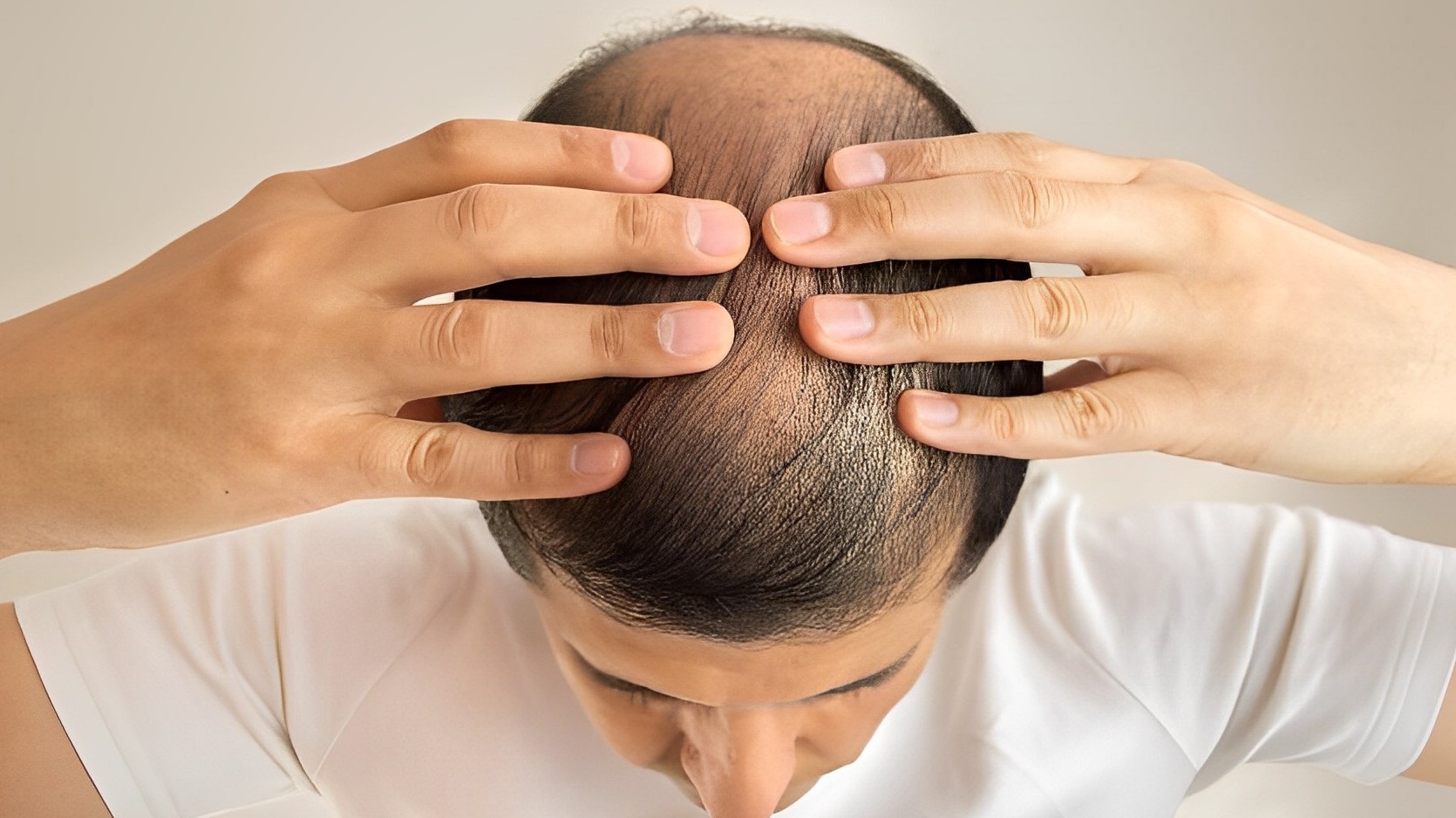 Xịt dưỡng tóc Skinze tinh dầu bưởi vitamin b5 biotin collagen kích thích  mọc tóc dưỡng tóc khô tóc uốn tóc nhuộm tóc gãy rụng