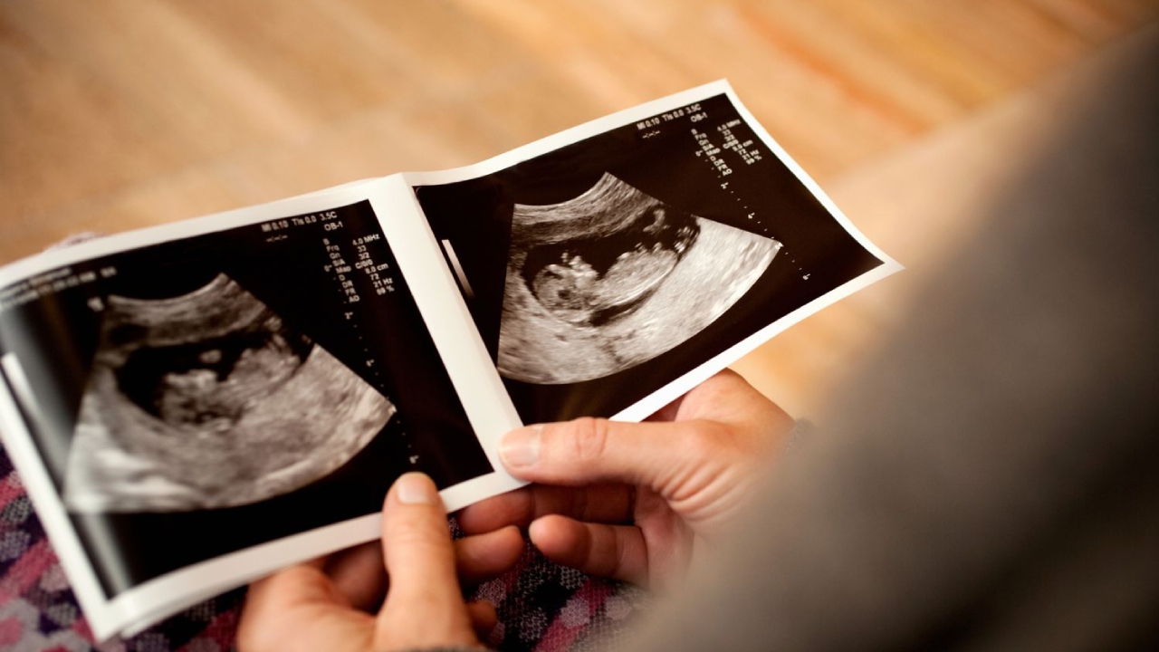 Làm sao nhìn hình siêu âm để biết được giới tính (trai hay gái) của thai nhi?