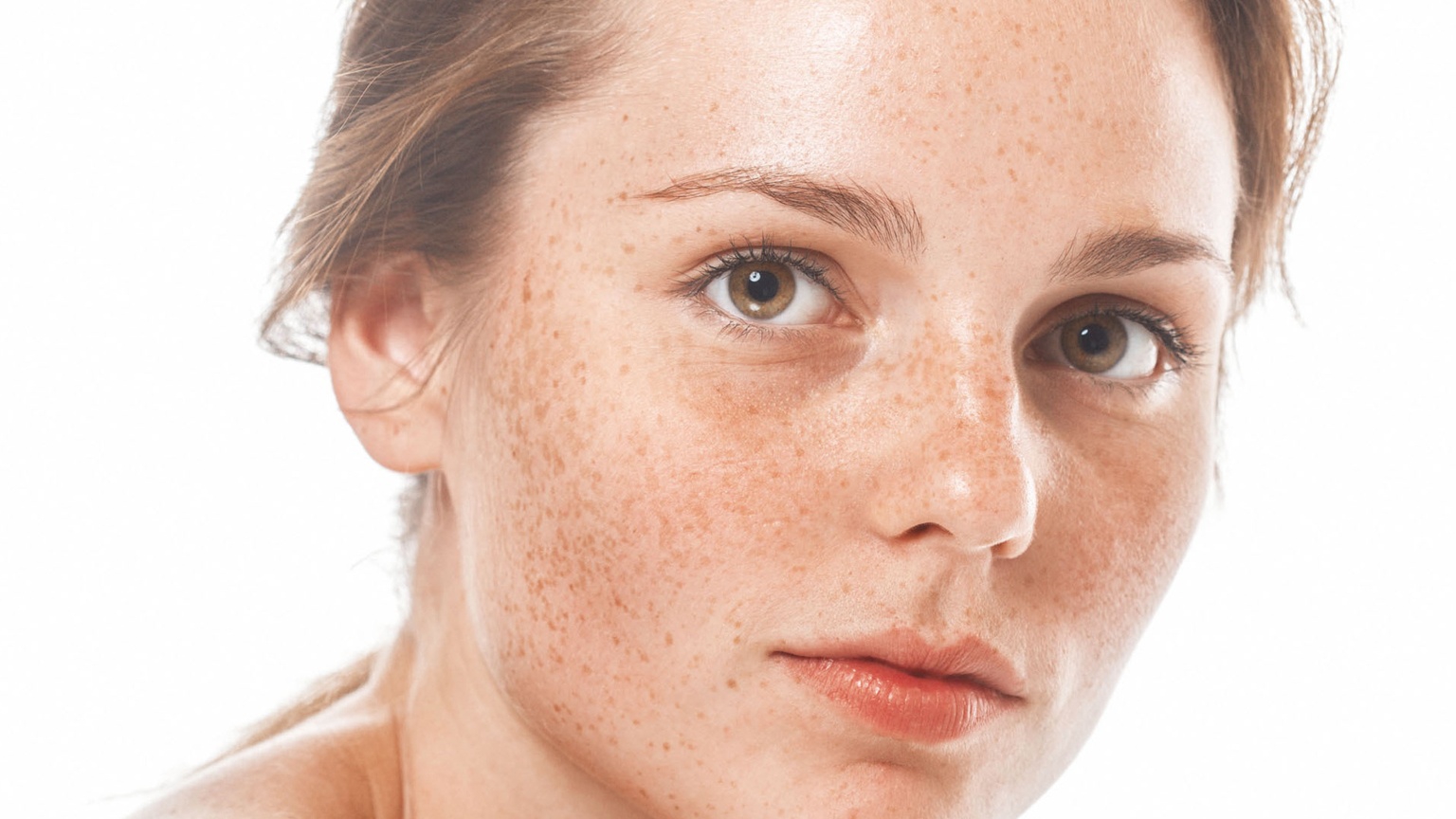 Có tự nhiên liệu rối loạn sắc tố da có thể tự điều trị được không?
