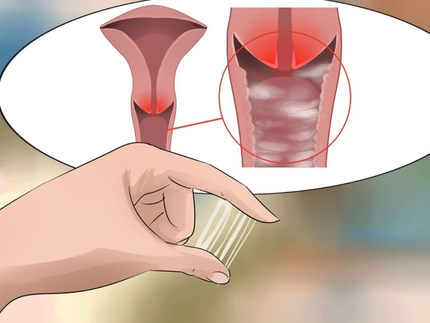 Cách trị viêm âm đạo dân gian cho phụ nữ áp dụng từ những nguyên liệu ngay tại nhà 1