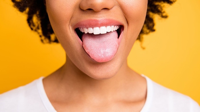 Rát lưỡi có liên quan đến bệnh nấm miệng không?
