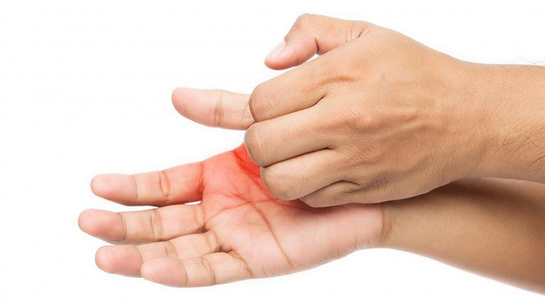 Mọc mụn nước ở lòng bàn tay và bàn chân có liên quan đến các bệnh lý khác không?