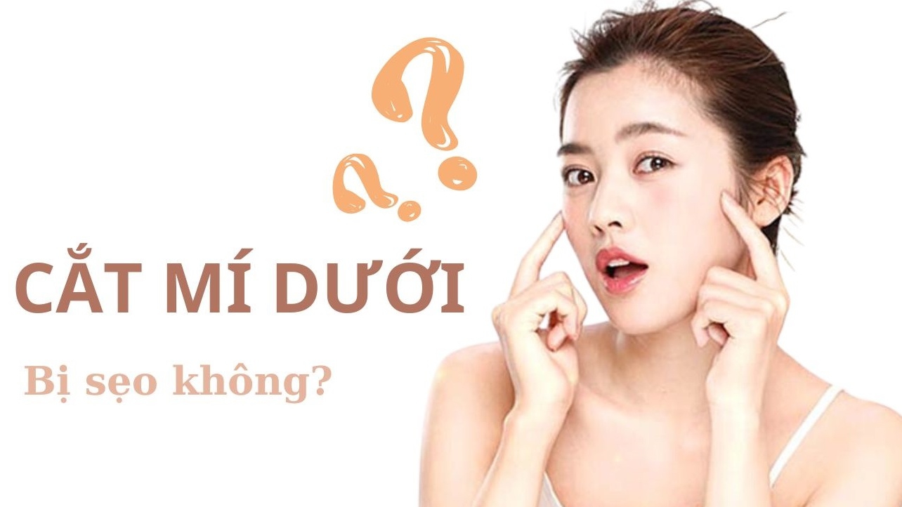 Cắt mí dưới có để lại sẹo không? Cách phòng sẹo khi cắt mí dưới