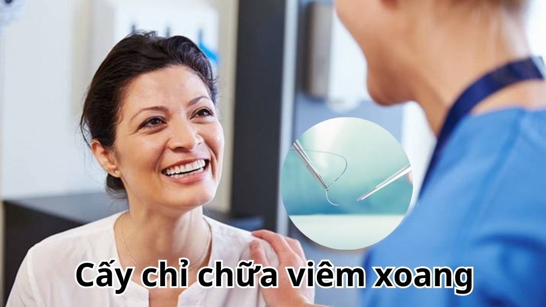 Phương pháp cấy chỉ chữa viêm xoang có hiệu quả không?