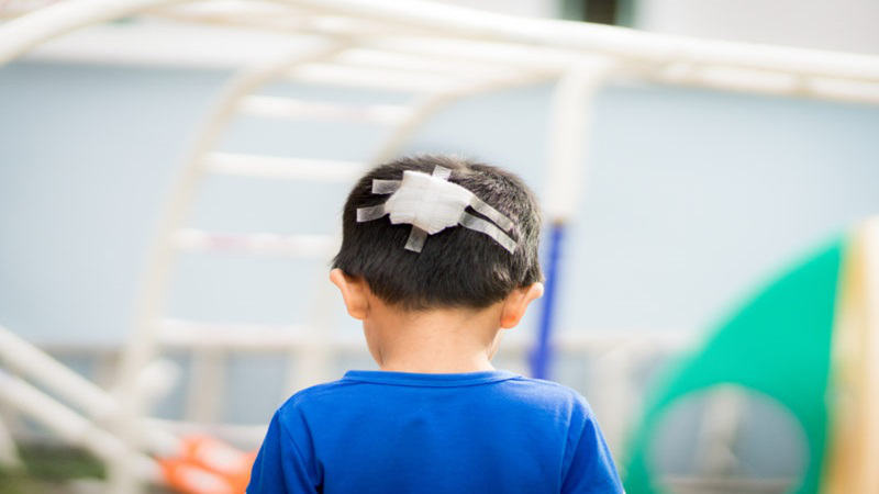 Chấn thương đầu ở trẻ em: Nguyên nhân, cách xử trí và phòng ngừa 3