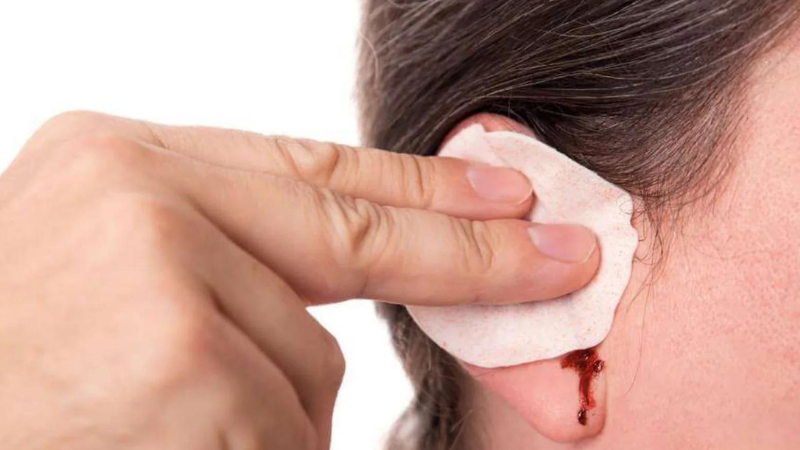 Chảy máu tai có nguy hiểm không? Nguyên nhân và cách xử trí 1