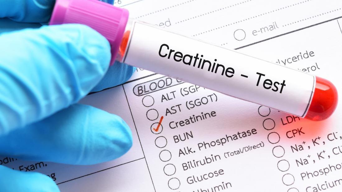 Chỉ số creatinin là gì?