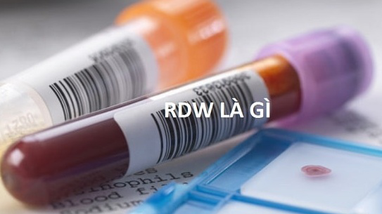 Chỉ số RDW-Sd trong máu có thể biểu hiện các bệnh lý nào?

