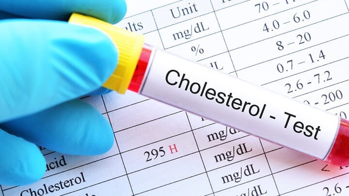 cholesterol-bao-nhieu-la-nguy-hiem-cach-kiem-soat-nong-do-cholesterol-trong-mau 3