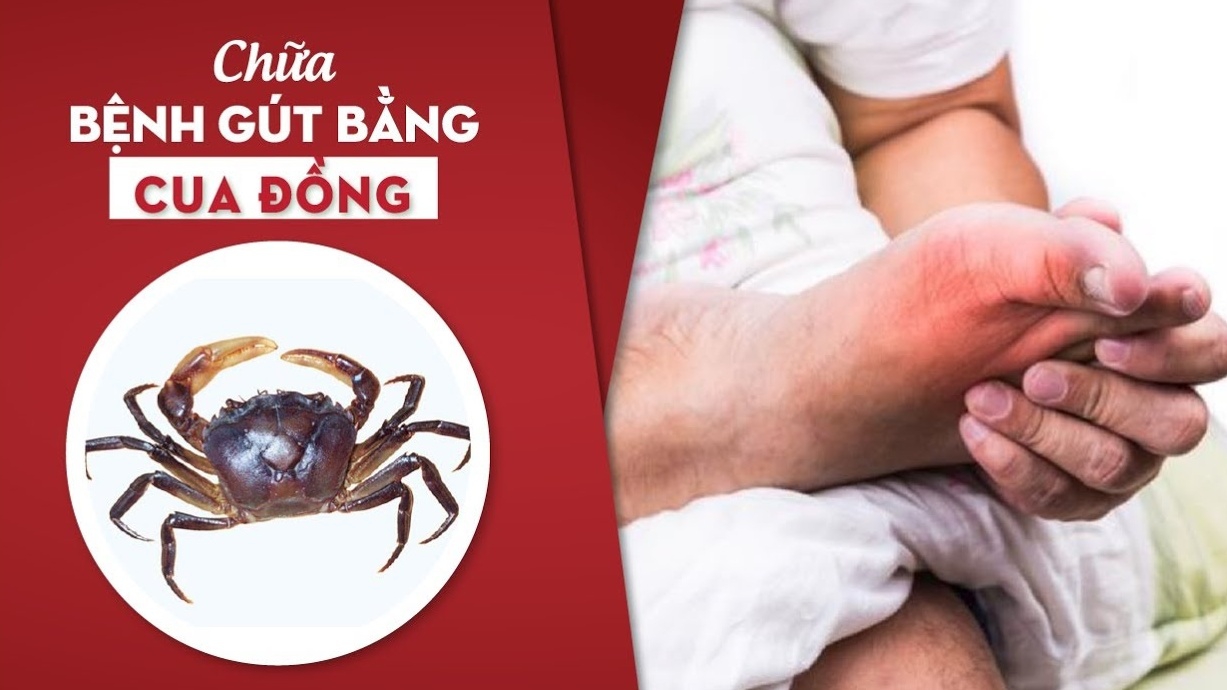 Chữa gout bằng cua đồng có hiệu quả không?