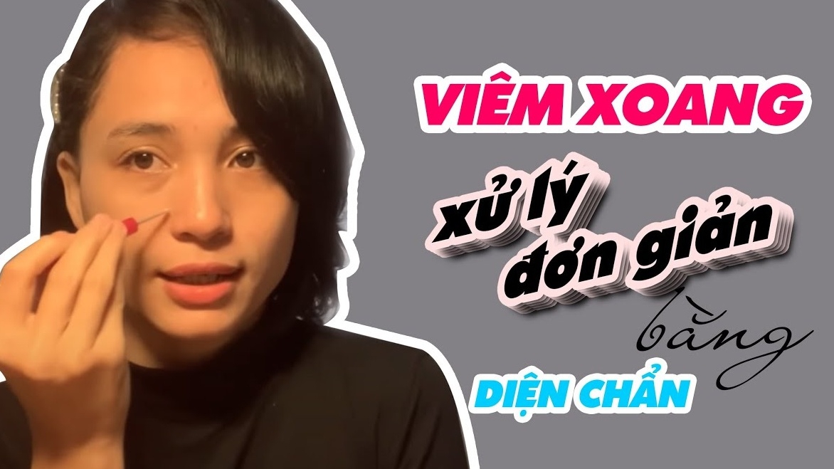 Chi tiết về cách chữa viêm xoang bằng diện chẩn