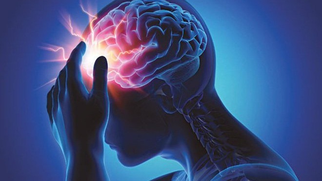 Chụp cộng hưởng từ não là gì? Khi nào cần chụp chụp cộng hưởng từ não? 4