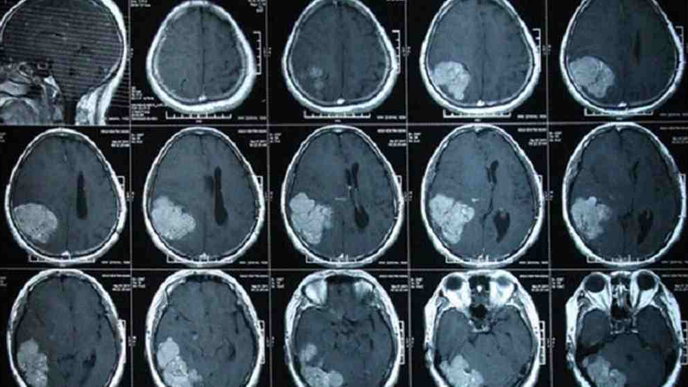 Có những biện pháp nào để giảm rủi ro khi chụp CT?
