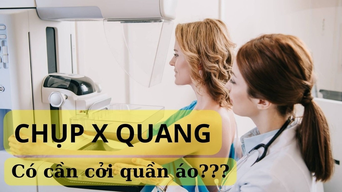 Chụp X quang có cần cởi quần áo không?