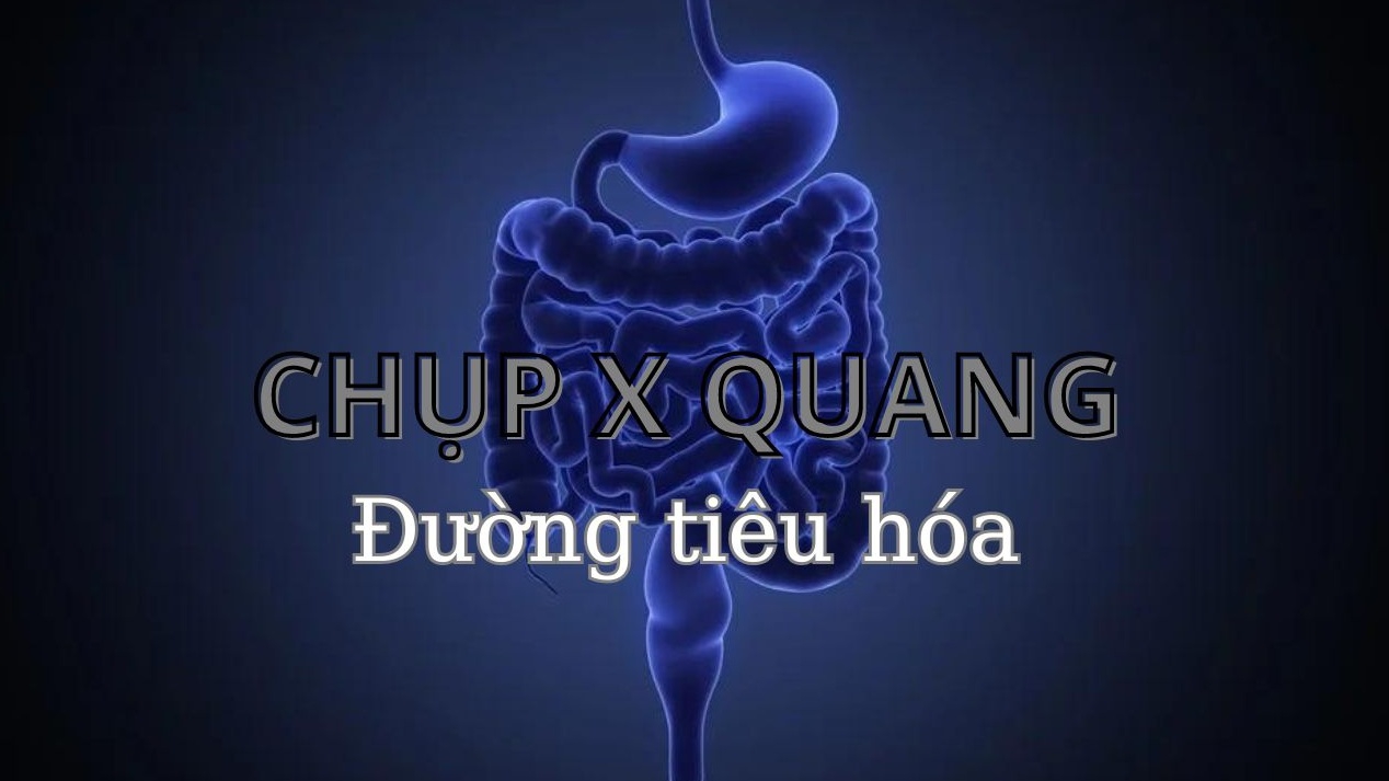 Chụp X - quang đường tiêu hóa: Khi nào cần thực hiện? Quy trình ra sao?