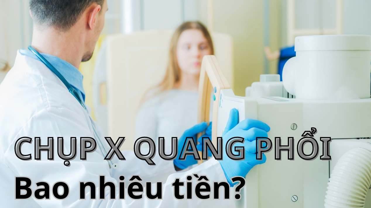 Chụp X quang phổi bao nhiêu tiền?