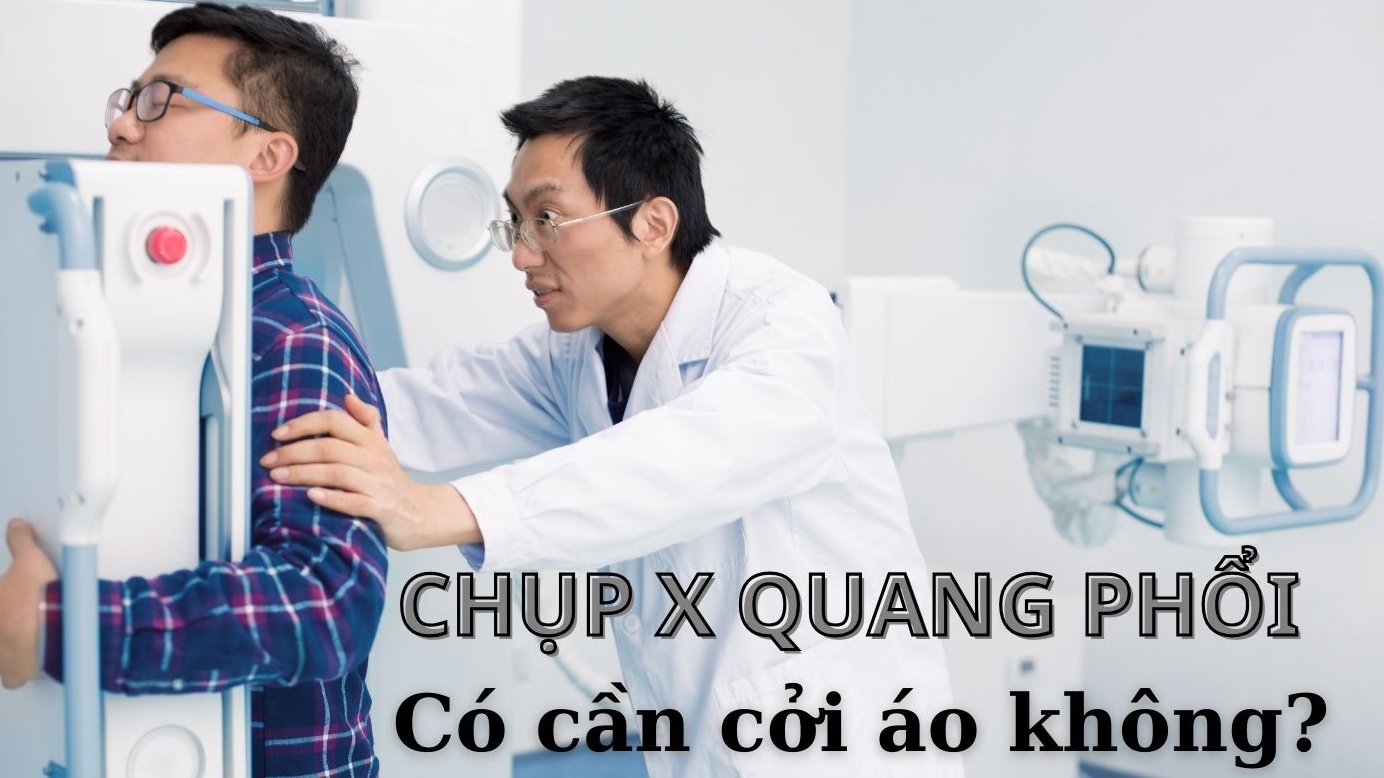 Chụp X quang phổi có cần cởi áo không?