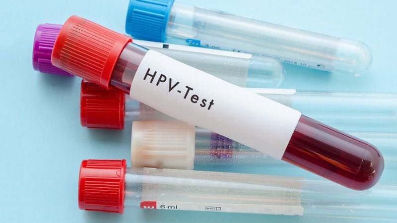 Có cần xét nghiệm trước khi đi tiêm HPV hay không? 2