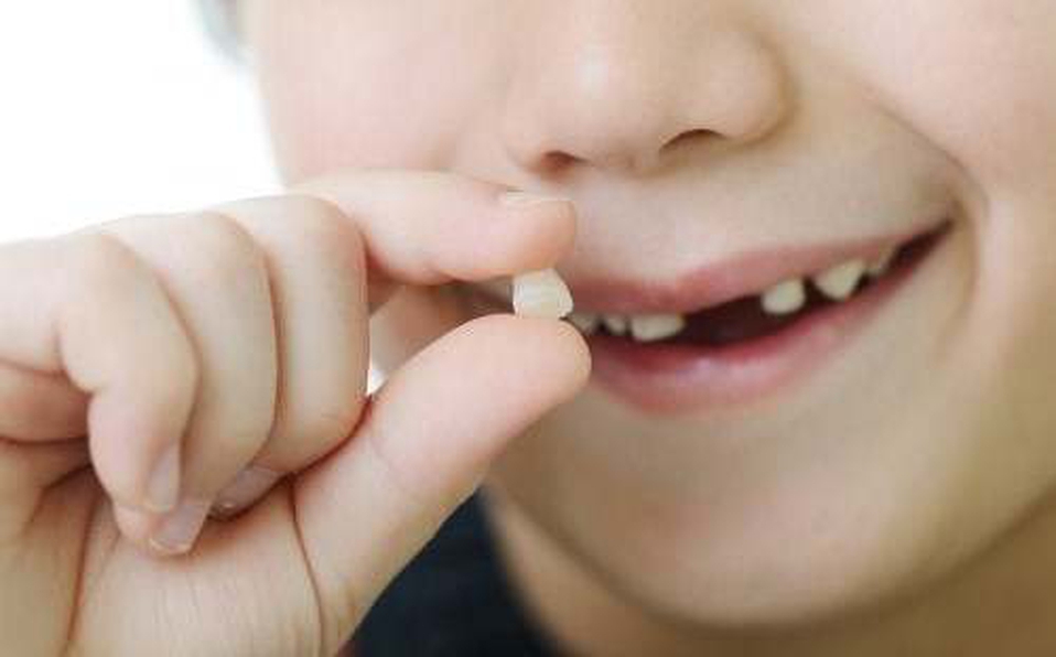  Có nên nhổ răng sữa khi chưa lung lay ? Tư vấn và hướng dẫn cho phụ huynh