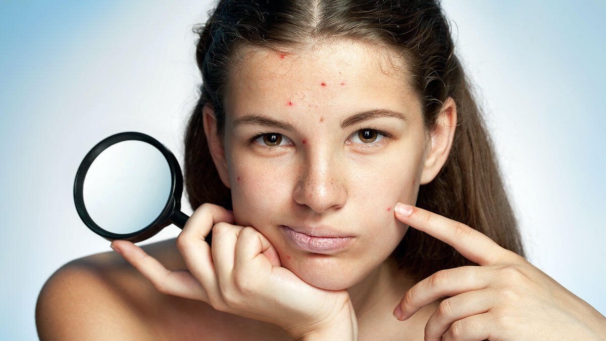 Peel da là gì và có tác dụng gì đối với làn da?
