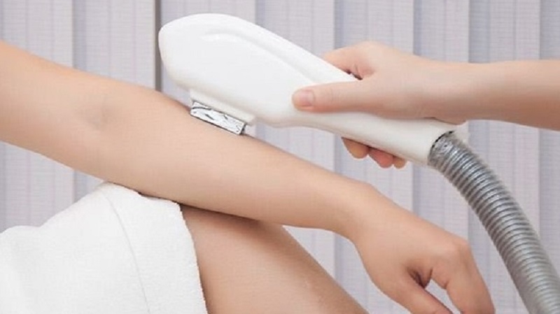 Công nghệ triệt lông Diode Laser là gì? Những lợi ích khi sử dụng