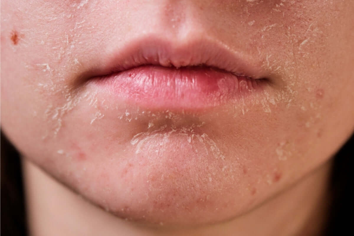 Có thể có bất kỳ tác động phụ nào khi sử dụng các sản phẩm chăm sóc da mặt khô sần và ngứa?
