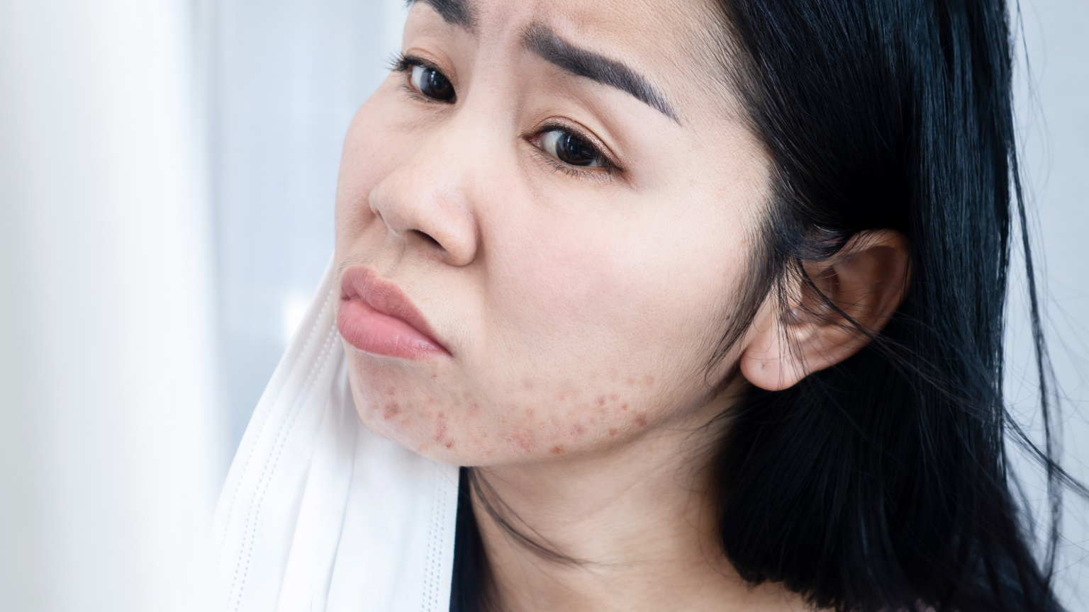 Tình trạng da mặt bị nổi mụn nước nhỏ có thể gây hậu quả gì?
