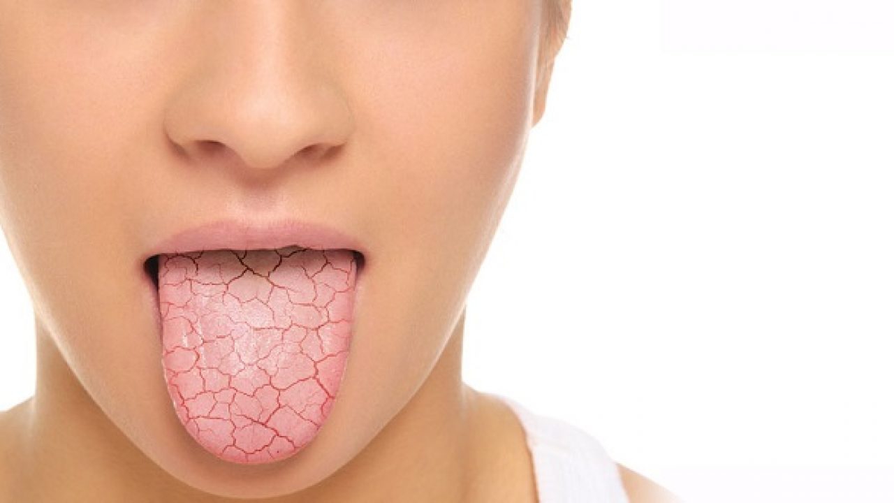 Đắng miệng có phải là dấu hiệu của ung thư miệng và họng không?