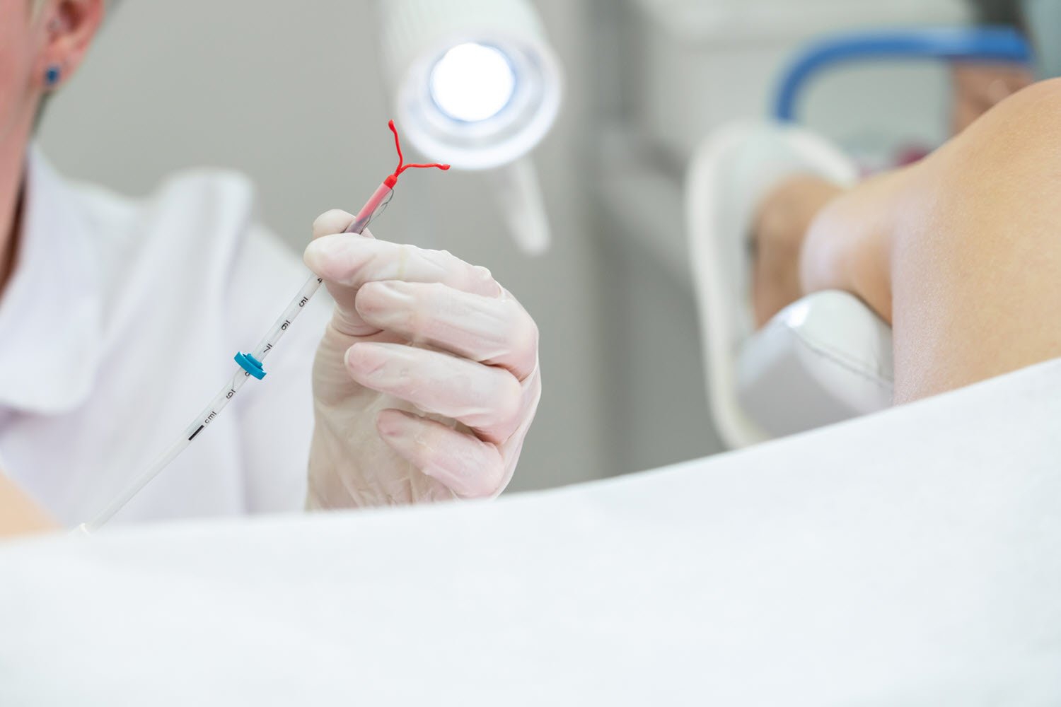 Đặt vòng tránh thai lâu có tác động gì tới sức khỏe không?