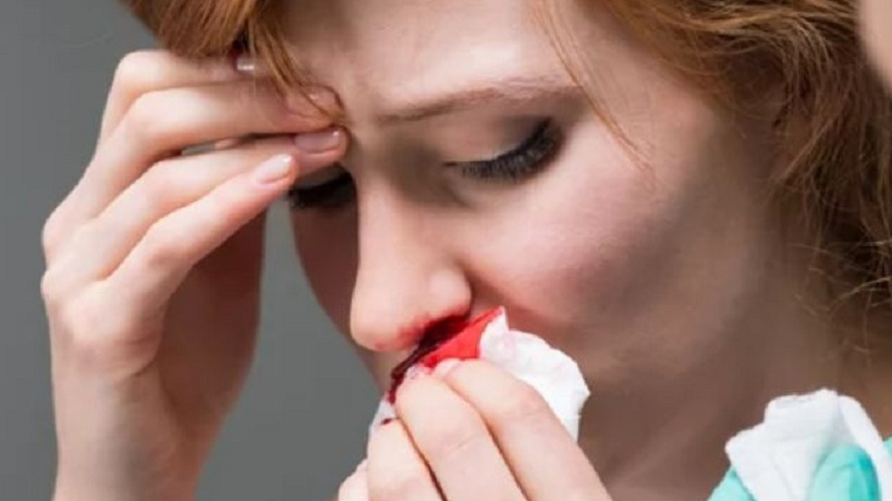Thông tin về nhức đầu chảy máu mũi là bệnh gì là bệnh gì?