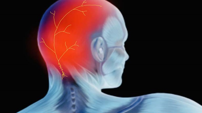 Đau đầu sau tai: Nguyên nhân và cách điều trị dứt điểm 1