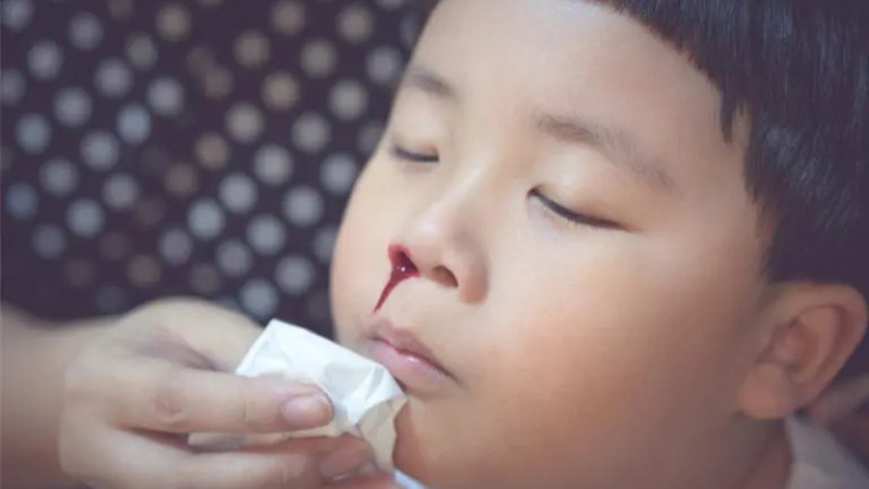 Dấu hiệu sốt xuất huyết ở trẻ​ và cách phòng ngừa 3
