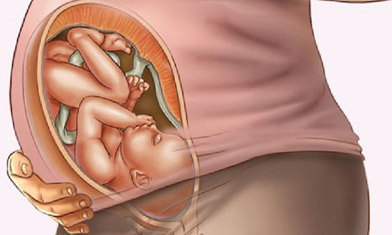 Quay đầu có ảnh hưởng gì đến mẹ và thai nhi?
