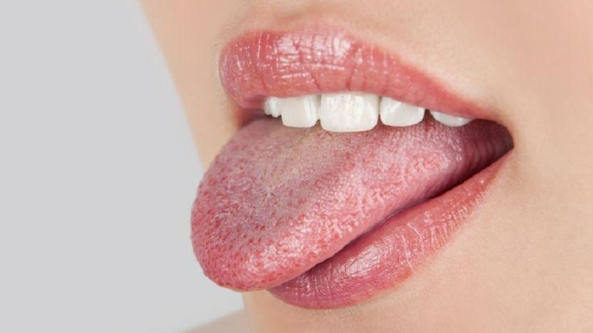 Các biện pháp tự nhiên giúp giảm triệu chứng nhiệt miệng nổi mụn ở lưỡi?
