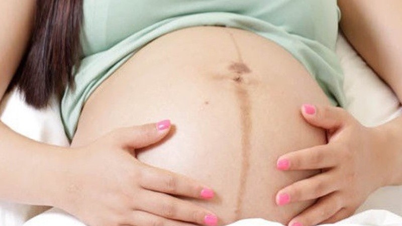 Có những nguyên nhân nào khác gây đau bụng ngay rốn khi mang thai?
