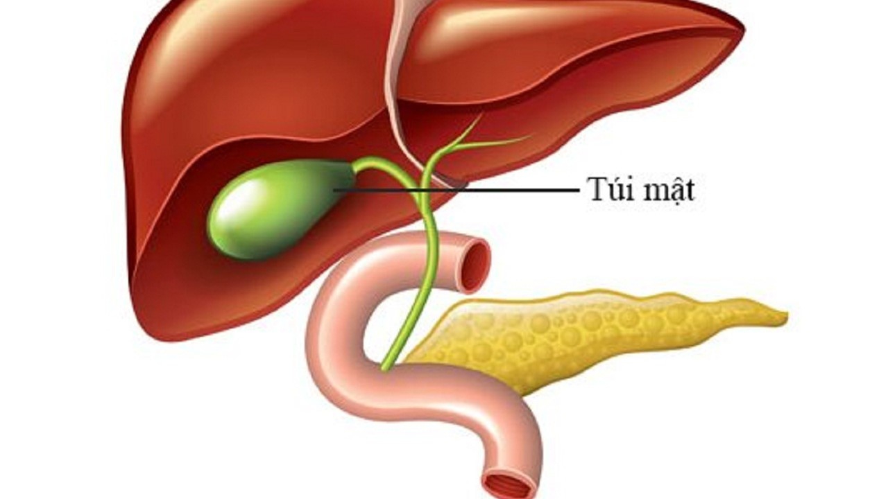 Đau sỏi mật là gì? Dấu hiệu và biện pháp phòng ngừa hiệu quả