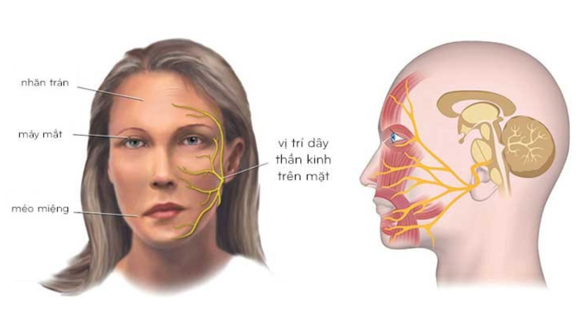 Dây thần kinh số 7 nằm ở đâu? Nguyên nhân tổn thương dây thần kinh số 7