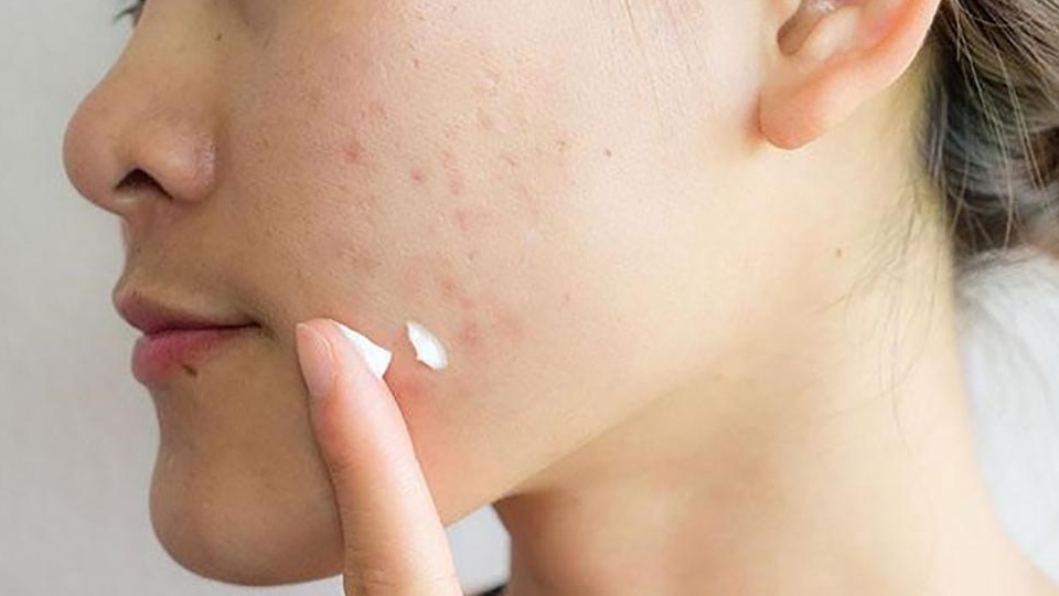 Da mặt bị ngứa nếu không được điều trị có gây hậu quả không?
