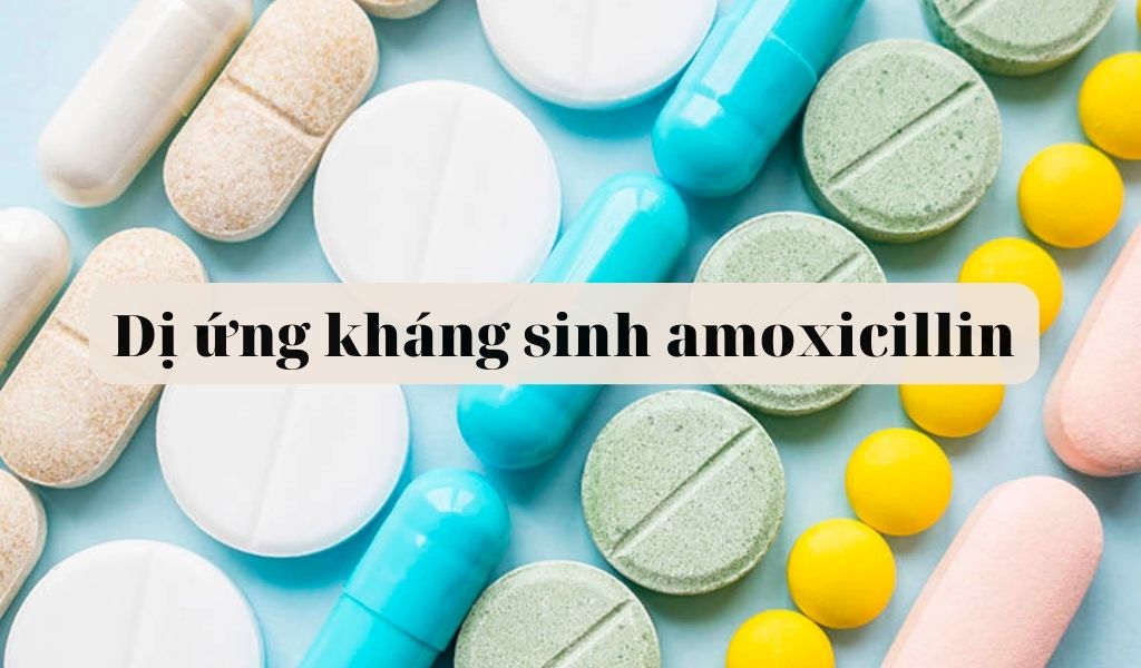 Amoxicillin có tương tác thuốc nào khác không?
